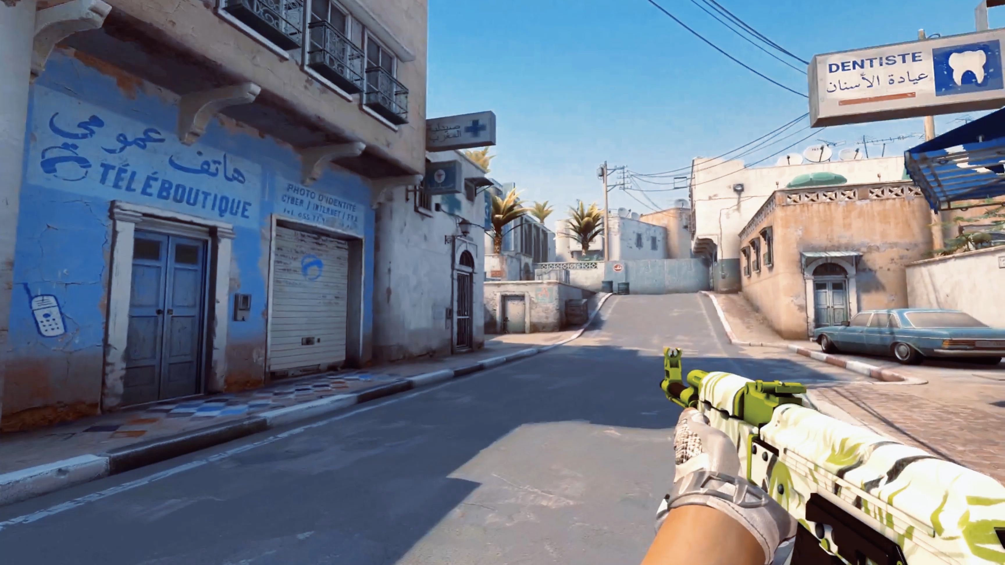 任何人的传奇结束了 Top Esports 的连胜， Oh My God 在 LPL 第二阶段2025中击败了 Ultra Prime 。